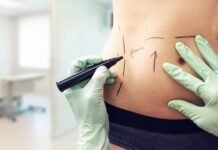 Full or Mini Tummy Tuck: Making the Best Decision for Your Body